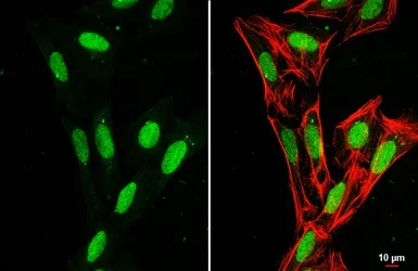 Immunocytochemistry/ Immunofluorescence - Anti-Histone H1.0 antibody (AB154111)