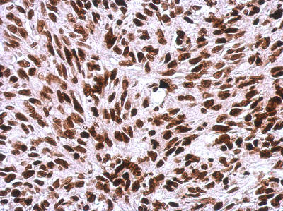 Immunohistochemistry (Formalin/PFA-fixed paraffin-embedded sections) - Anti-Histone H1.0 antibody (AB154111), expandable thumbnail