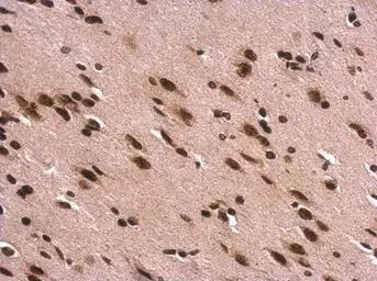 Immunohistochemistry (Formalin/PFA-fixed paraffin-embedded sections) - Anti-Histone H1.0 antibody (AB154111)