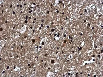Immunohistochemistry (Formalin/PFA-fixed paraffin-embedded sections) - Anti-Histone H1.0 antibody (AB154111)
