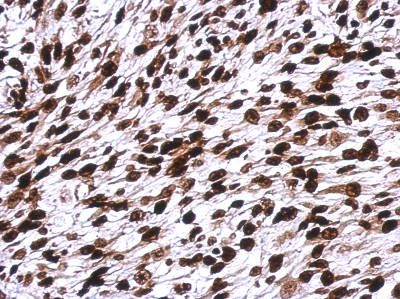 Immunohistochemistry (Formalin/PFA-fixed paraffin-embedded sections) - Anti-Histone H1.0 antibody (AB154111), expandable thumbnail