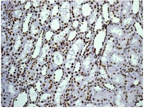 Immunohistochemistry (Formalin/PFA-fixed paraffin-embedded sections) - Anti-Histone H1.0 antibody [EPR6537] (ab125027), expandable thumbnail