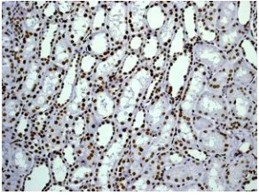Immunohistochemistry (Formalin/PFA-fixed paraffin-embedded sections) - Anti-Histone H1.0 antibody [EPR6537] (AB125027)
