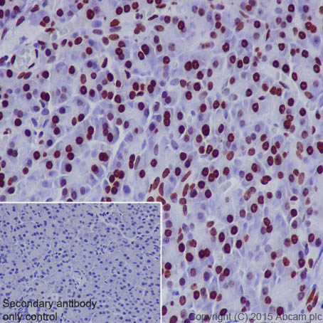 Immunohistochemistry (Formalin/PFA-fixed paraffin-embedded sections) - Anti-Histone H1.0 antibody [EPR6537] (AB125027), expandable thumbnail