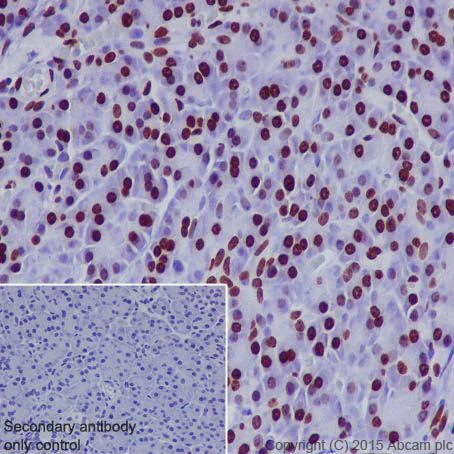 Immunohistochemistry (Formalin/PFA-fixed paraffin-embedded sections) - Anti-Histone H1.0 antibody [EPR6537] (AB125027)