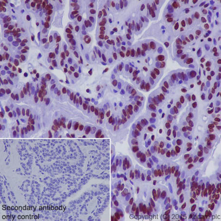 Immunohistochemistry (Formalin/PFA-fixed paraffin-embedded sections) - Anti-Histone H1.0 antibody [EPR6537] (AB125027), expandable thumbnail