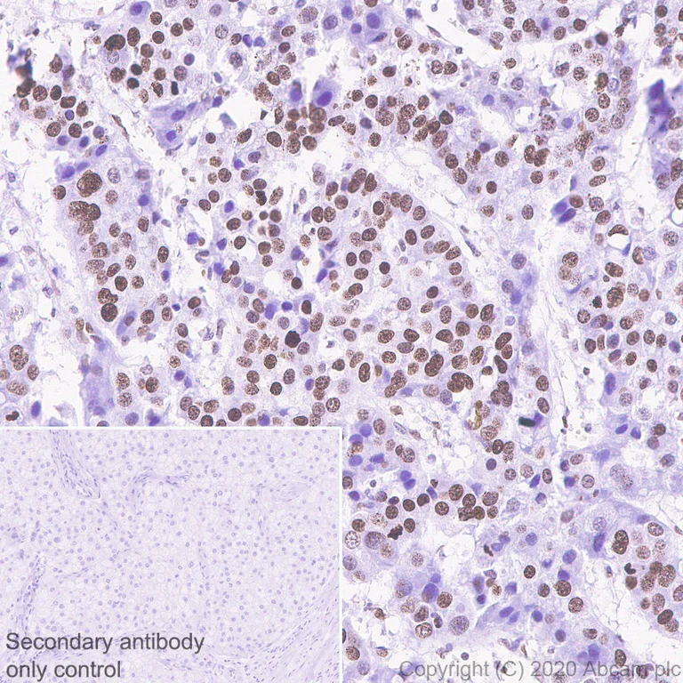 Immunohistochemistry (Formalin/PFA-fixed paraffin-embedded sections) - Anti-Histone H1.1 antibody [EPR23191-14] (AB254394)