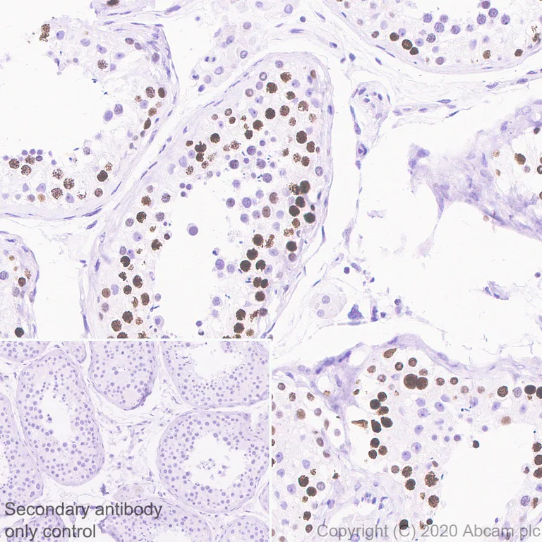 Immunohistochemistry (Formalin/PFA-fixed paraffin-embedded sections) - Anti-Histone H1.1 antibody [EPR23191-14] - BSA and Azide free (AB279642)