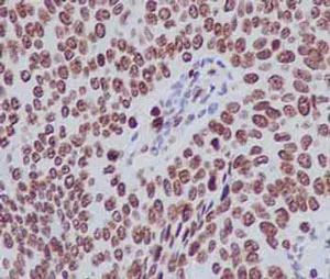 Immunohistochemistry (Formalin/PFA-fixed paraffin-embedded sections) - Anti-Histone H1.3 antibody [EPR12683] (AB183736)