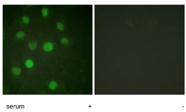 Immunocytochemistry/ Immunofluorescence - Anti-Histone H1.3 + Histone H1.4 antibody (AB61177)