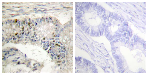 Immunohistochemistry (Formalin/PFA-fixed paraffin-embedded sections) - Anti-Histone H1.3 + Histone H1.4 antibody (AB61177)