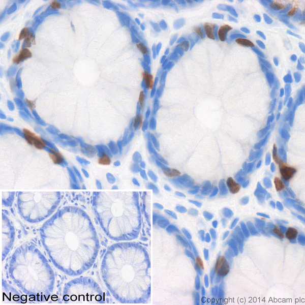 Immunohistochemistry (Formalin/PFA-fixed paraffin-embedded sections) - Anti-Histone H1.3 + Histone H1.4 antibody (AB61177)