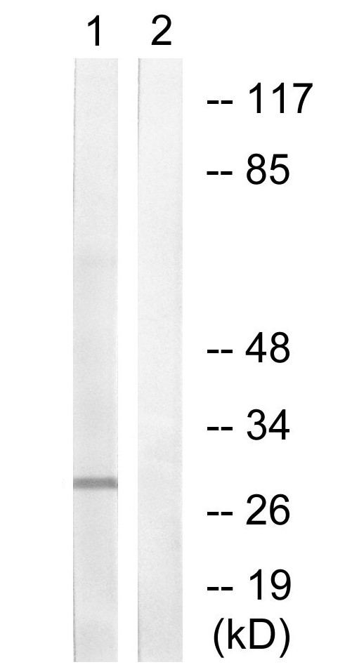 Anti-Histone H1.3 + Histone H1.4 antibody
