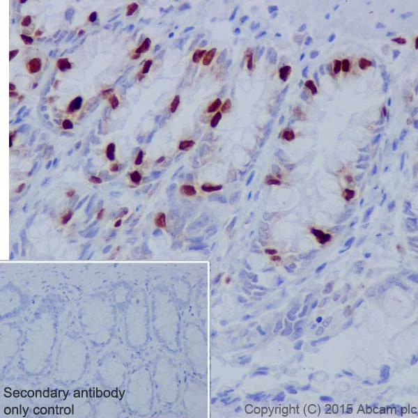 Immunohistochemistry (Formalin/PFA-fixed paraffin-embedded sections) - Anti-Histone H1.3 (phospho T17) + Histone H1.4 (phospho T17) antibody [EPR18087] (AB188294)