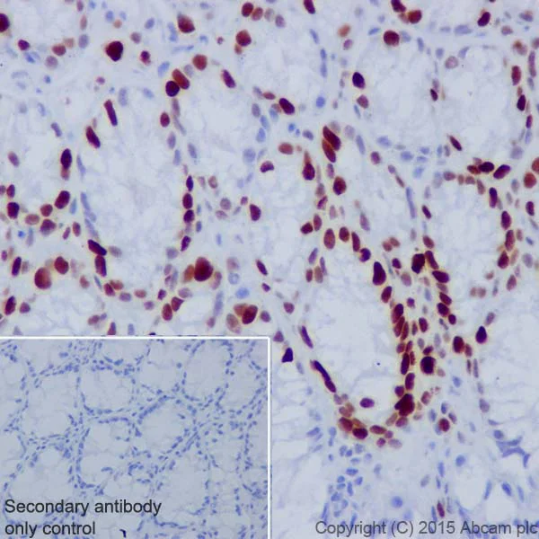 Immunohistochemistry (Formalin/PFA-fixed paraffin-embedded sections) - Anti-Histone H1.3 (phospho T17) + Histone H1.4 (phospho T17) antibody [EPR18087] - BSA and Azide free (AB250946)