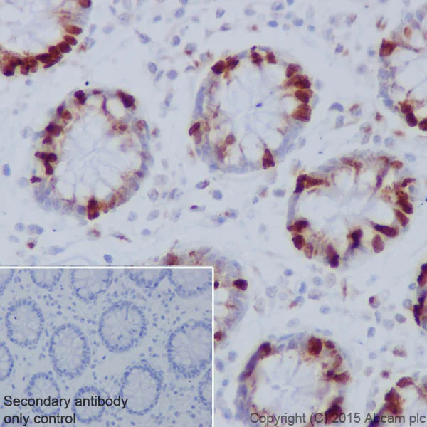Immunohistochemistry (Formalin/PFA-fixed paraffin-embedded sections) - Anti-Histone H1.3 (phospho T17) + Histone H1.4 (phospho T17) antibody [EPR18087] - BSA and Azide free (AB250946)