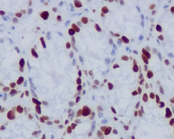 Immunohistochemistry (Formalin/PFA-fixed paraffin-embedded sections) - Anti-Histone H1.4 (phospho T17) antibody [SR1513] (AB326647)