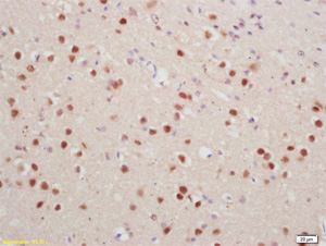 Immunohistochemistry (Formalin/PFA-fixed paraffin-embedded sections) - Anti-Histone H1.4 (phospho T18) antibody (AB203624)