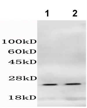 Western blot - Anti-Histone H1.4 (phospho T18) antibody (AB203624)