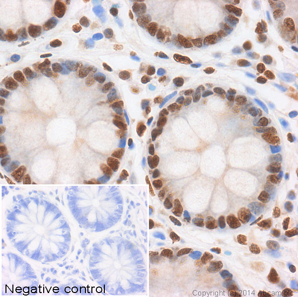 Immunohistochemistry (Formalin/PFA-fixed paraffin-embedded sections) - Anti-Histone H2A (acetyl K5) antibody (AB1764), expandable thumbnail
