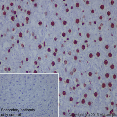 Immunohistochemistry (Formalin/PFA-fixed paraffin-embedded sections) - Anti-Histone H2A (acetyl K5) antibody [EP856Y] - BSA and Azide free (AB247302), expandable thumbnail