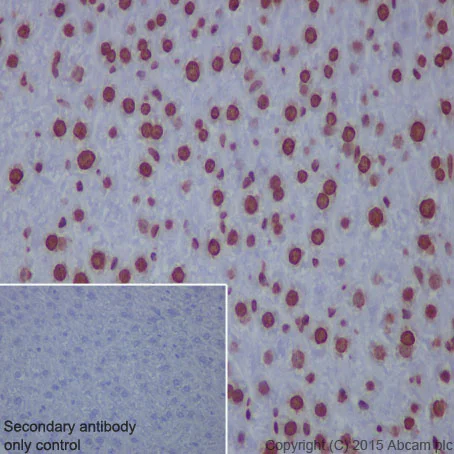 Immunohistochemistry (Formalin/PFA-fixed paraffin-embedded sections) - Anti-Histone H2A (acetyl K5) antibody [EP856Y] - BSA and Azide free (AB247302)