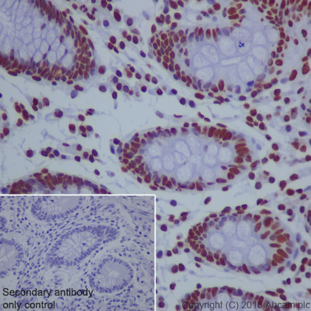 Immunohistochemistry (Formalin/PFA-fixed paraffin-embedded sections) - Anti-Histone H2A (acetyl K5) antibody [EP856Y] - BSA and Azide free (ab247302), expandable thumbnail