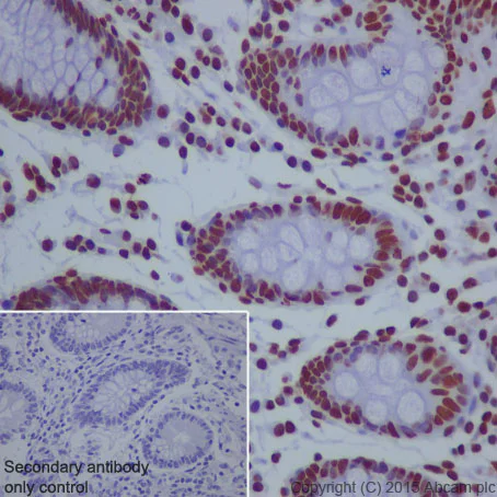 Immunohistochemistry (Formalin/PFA-fixed paraffin-embedded sections) - Anti-Histone H2A (acetyl K5) antibody [EP856Y] - BSA and Azide free (AB247302)