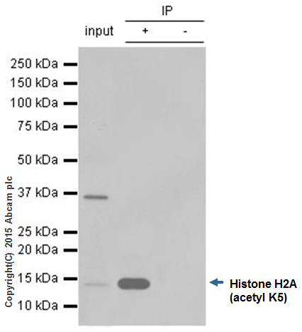 Immunoprecipitation - Anti-Histone H2A (acetyl K5) antibody [EP856Y] - BSA and Azide free (AB247302), expandable thumbnail