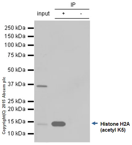 Immunoprecipitation - Anti-Histone H2A (acetyl K5) antibody [EP856Y] - BSA and Azide free (AB247302)