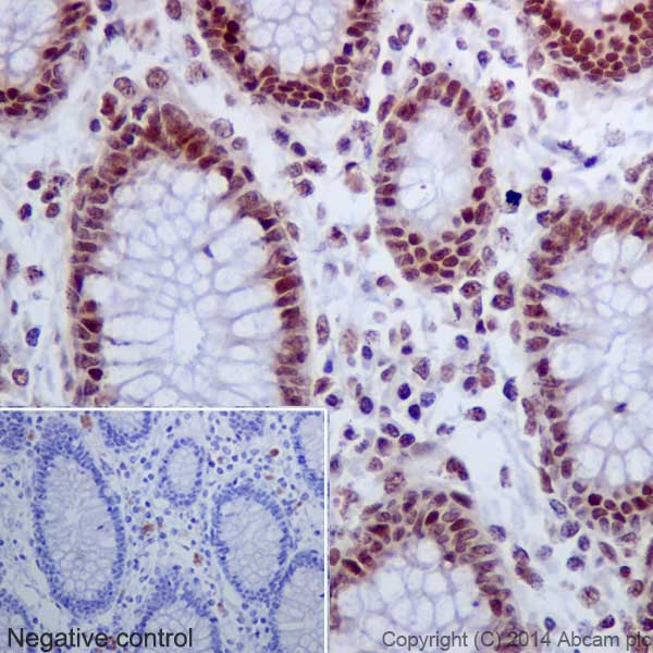 Immunohistochemistry (Formalin/PFA-fixed paraffin-embedded sections) - Anti-Histone H2A (acetyl K9) antibody [EPR17471] - ChIP Grade - BSA and Azide free (AB203949)