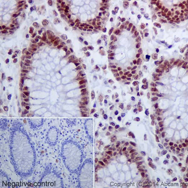 Immunohistochemistry (Formalin/PFA-fixed paraffin-embedded sections) - Anti-Histone H2A (acetyl K9) antibody [EPR17471] - ChIP Grade - BSA and Azide free (AB203949)
