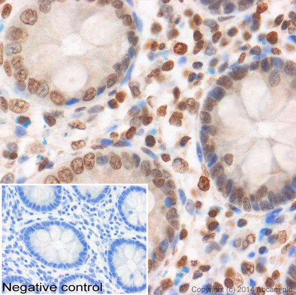 Immunohistochemistry (Formalin/PFA-fixed paraffin-embedded sections) - Anti-Histone H2A antibody - ChIP Grade (AB88770)