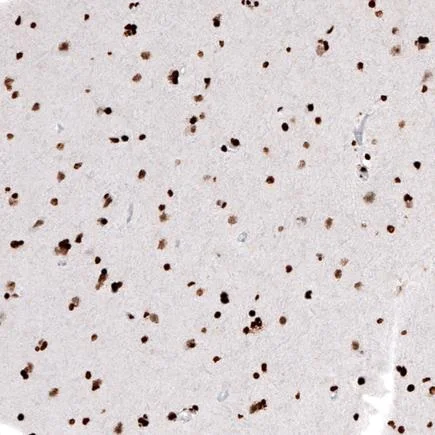 Immunohistochemistry (Formalin/PFA-fixed paraffin-embedded sections) - Anti-Histone H2A antibody [CL5039] (AB242365)