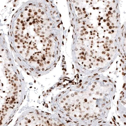 Immunohistochemistry (Formalin/PFA-fixed paraffin-embedded sections) - Anti-Histone H2A antibody [CL5039] (AB242365)