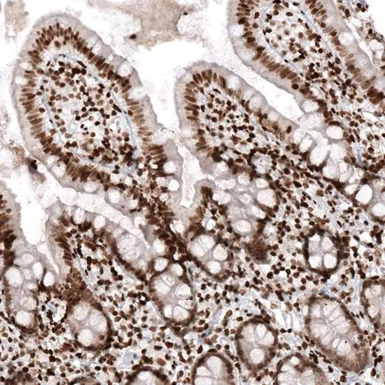 Immunohistochemistry (Formalin/PFA-fixed paraffin-embedded sections) - Anti-Histone H2A antibody [CL5039] (AB242365)