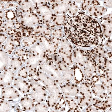 Immunohistochemistry (Formalin/PFA-fixed paraffin-embedded sections) - Anti-Histone H2A antibody [CL5039] (AB242365)