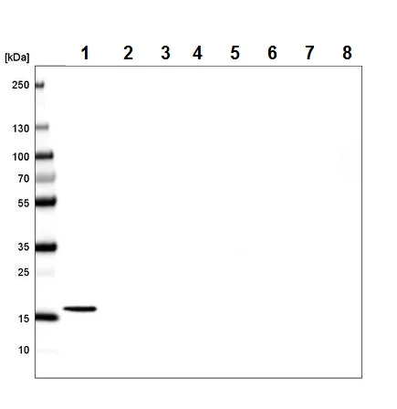 Western blot - Anti-Histone H2A antibody [CL5039] (AB242365)