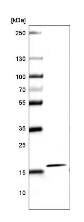 Western blot - Anti-Histone H2A antibody [CL5039] (AB242365)
