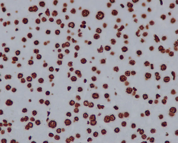 Immunohistochemistry (Formalin/PFA-fixed paraffin-embedded sections) - Anti-Histone H2A antibody [EPR895] - Nuclear Marker (AB124781)