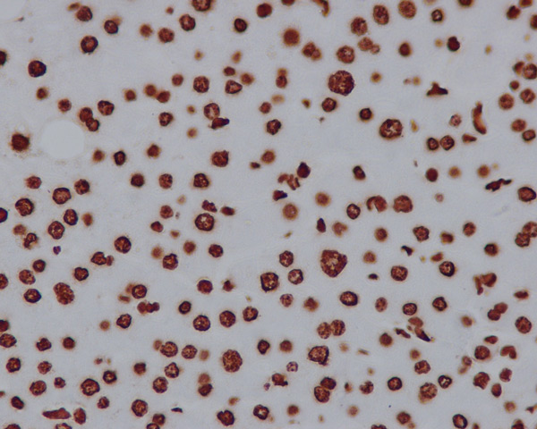 Immunohistochemistry (Formalin/PFA-fixed paraffin-embedded sections) - Anti-Histone H2A antibody [EPR895] - Nuclear Marker (AB124781)