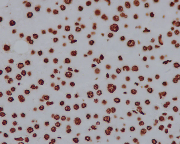 Immunohistochemistry (Formalin/PFA-fixed paraffin-embedded sections) - Anti-Histone H2A antibody [EPR895] - Nuclear Marker (AB124781)