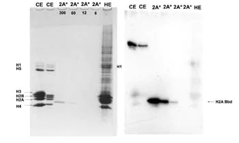 Western blot - Anti-Histone H2A-Bbd antibody (AB4175)