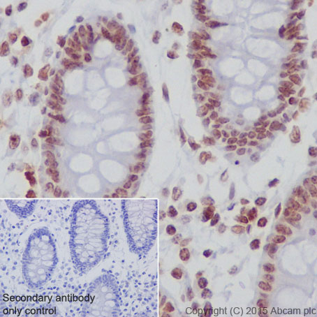 Immunohistochemistry (Formalin/PFA-fixed paraffin-embedded sections) - Anti-Histone H2A (hydroxyl Y39) antibody [EPR17683] (AB177377)