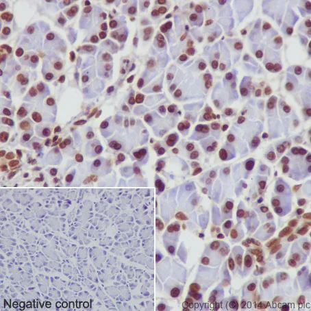 Immunohistochemistry (Formalin/PFA-fixed paraffin-embedded sections) - Anti-Histone H2A (mono methyl K118) antibody [EPR17488] (AB177387)