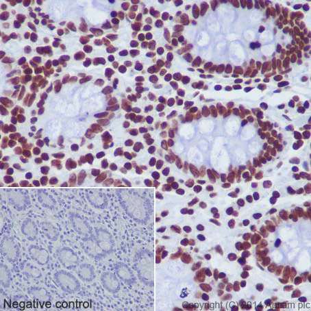 Immunohistochemistry (Formalin/PFA-fixed paraffin-embedded sections) - Anti-Histone H2A (mono methyl K118) antibody [EPR17488] - BSA and Azide free (AB249962)