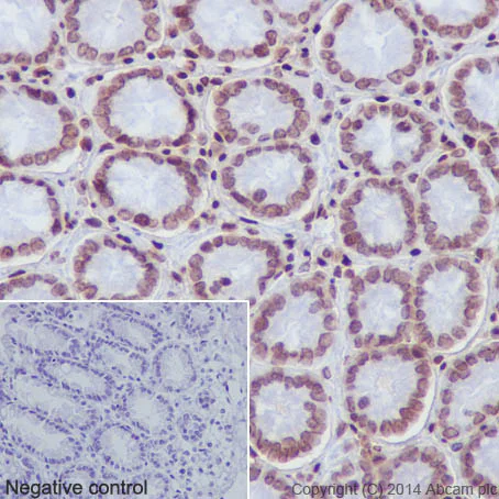 Immunohistochemistry (Formalin/PFA-fixed paraffin-embedded sections) - Anti-Histone H2A (mono methyl K118) antibody [EPR17488] - BSA and Azide free (AB249962)