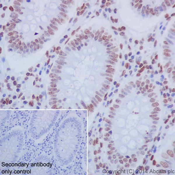 Immunohistochemistry (Formalin/PFA-fixed paraffin-embedded sections) - Anti-Histone H2A (mono methyl R3) + Histone H4 (mono methyl R3) antibody [EPR16995] (AB177186)