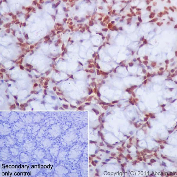 Immunohistochemistry (Formalin/PFA-fixed paraffin-embedded sections) - Anti-Histone H2A (mono methyl R3) + Histone H4 (mono methyl R3) antibody [EPR16995] (AB177186)