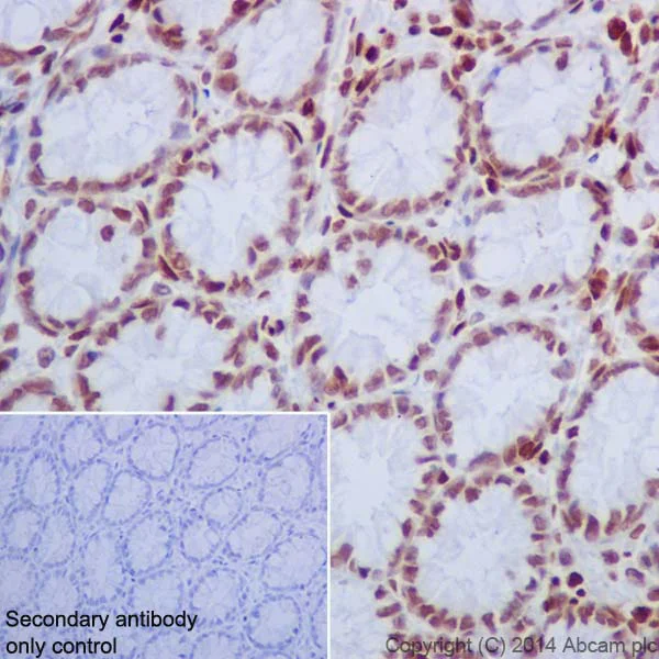 Immunohistochemistry (Formalin/PFA-fixed paraffin-embedded sections) - Anti-Histone H2A (mono methyl R3) + Histone H4 (mono methyl R3) antibody [EPR16995] (AB177186)